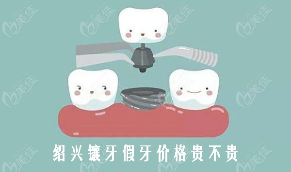 绍兴镶牙假牙价格贵不贵