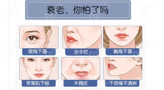 微拉美和小切口拉皮哪个成效好取决于你的面部皱纹情况