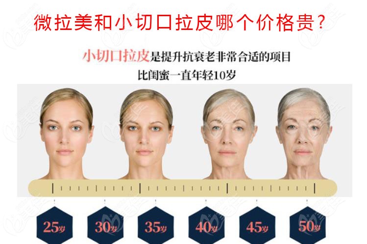 微拉美和小切口拉皮哪个价格贵
