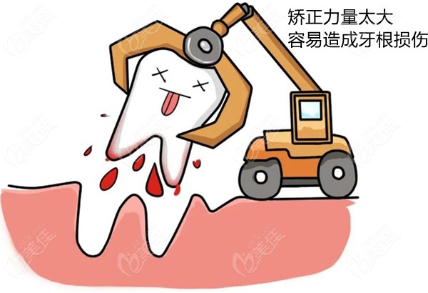 正畸会导致牙齿松动的后遗症吗