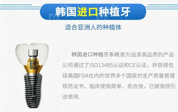性价比高的种植体品牌