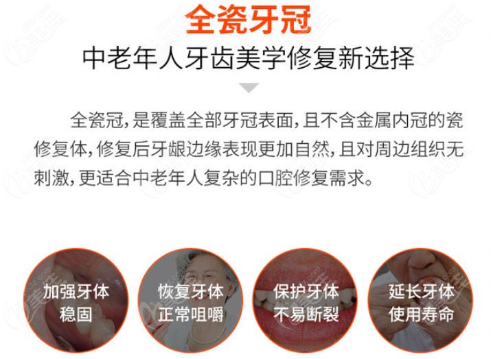 全瓷牙冠的优点了解下