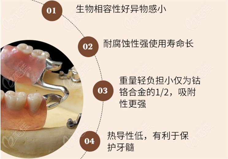 纯钛支架活动义齿的优点