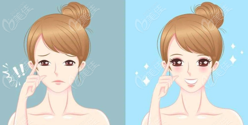 双眼皮失败修复可以做几次呢？