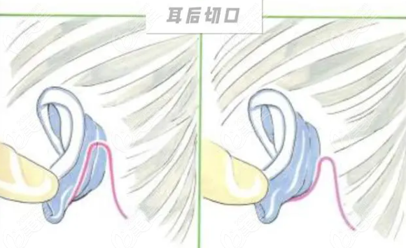 耳朵后面的结构图图片
