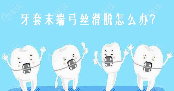 牙套末端弓丝滑脱怎么办
