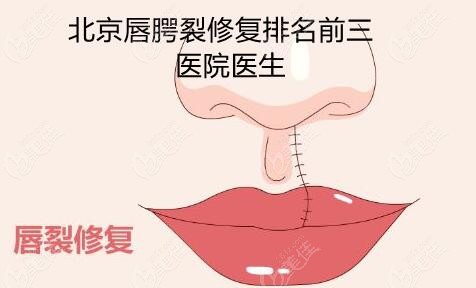 北京唇腭裂修复排名前三的医院医生