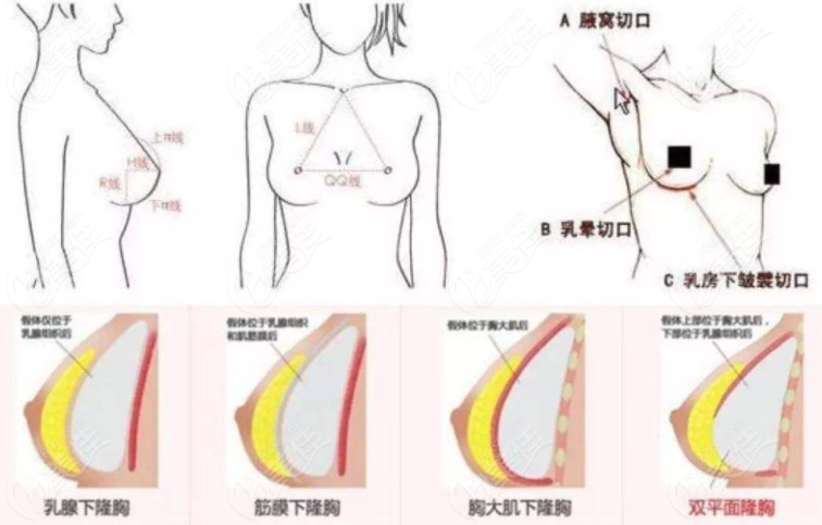 棉花糖丰胸图片