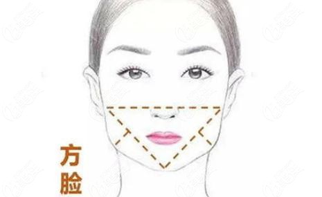 杭州做削骨好的医生说在杭州做方脸削骨价格要结合脸型来定