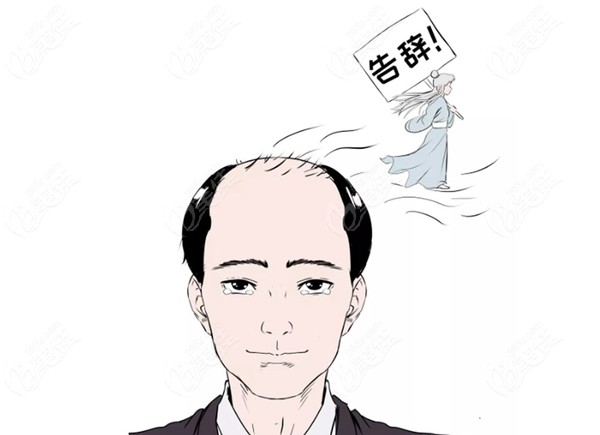 头发都跟咱说拜拜喽，肯定不允许呀
