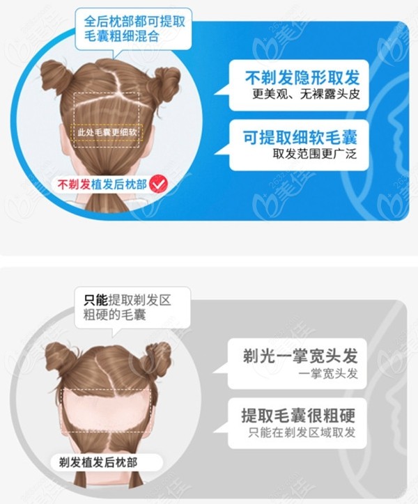 成都专注不剃发植发的机构