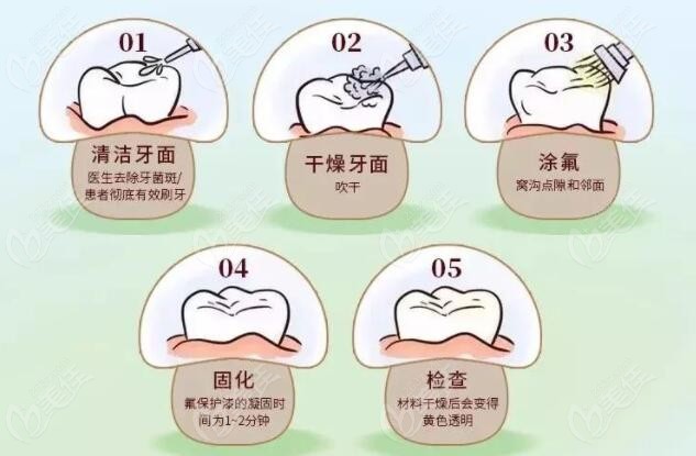 儿童涂氟的过程