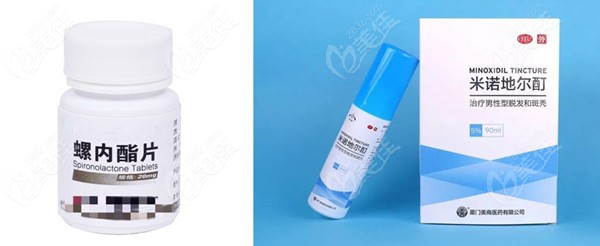 女性脂溢性脱发常用药有哪些