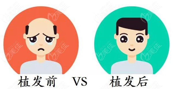 植发前后的差别