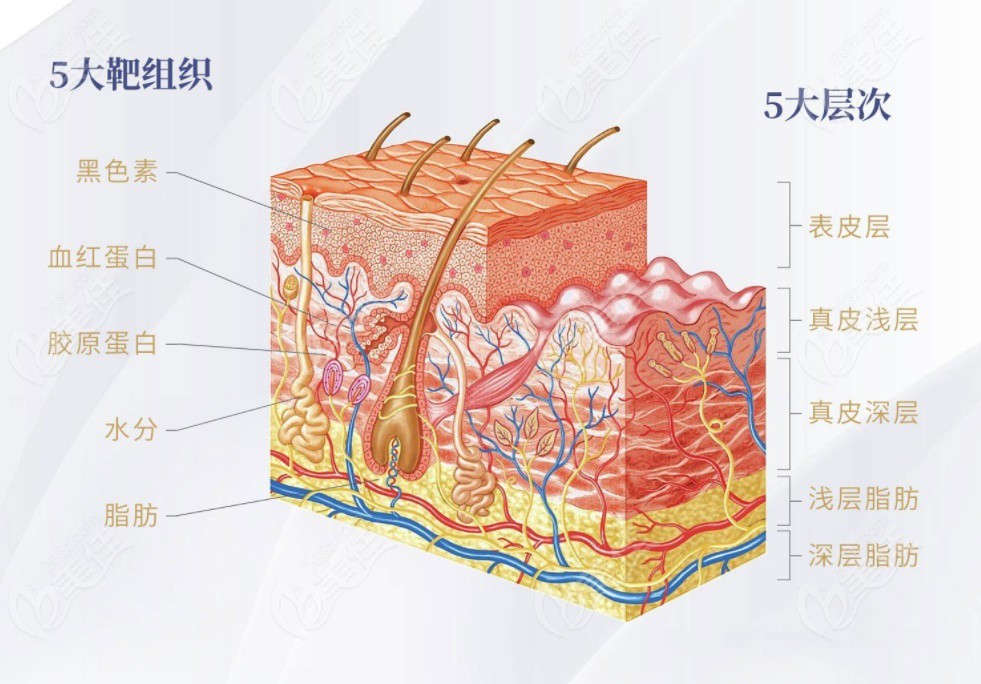 原理是:利用大范围温热效应提升紧致及局部溶脂,同时让浅表层皮肤美白