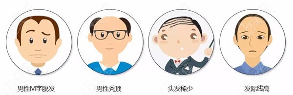 不同脱发症状植发价格不同