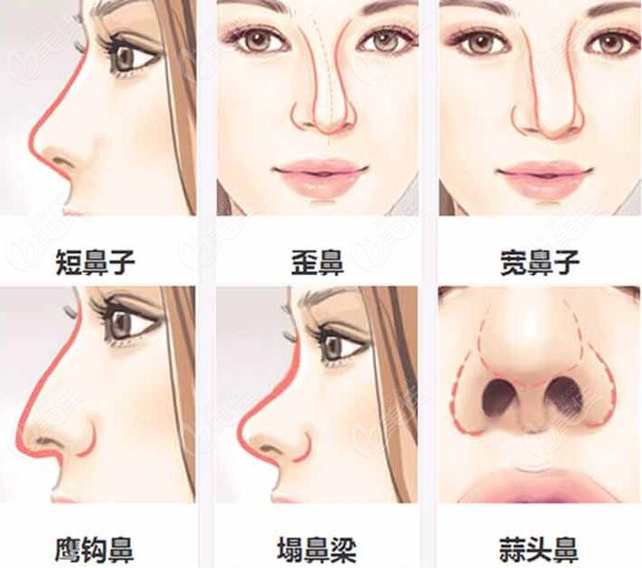 常见鼻部问题
