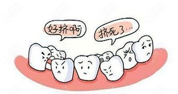牙齿畸形的图片