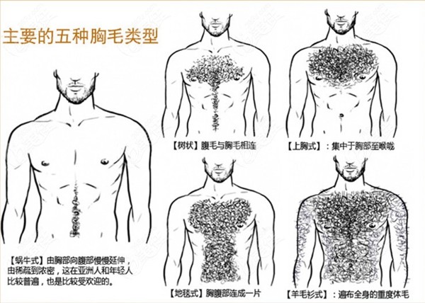 章贡区植胸毛类型