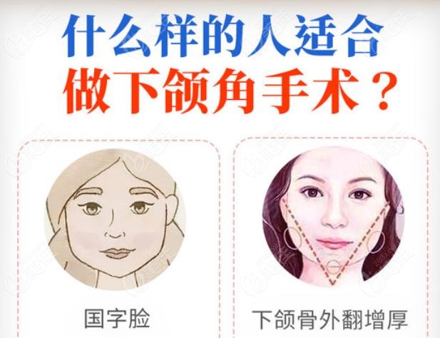 	国字方脸磨骨好还是垫下巴好
