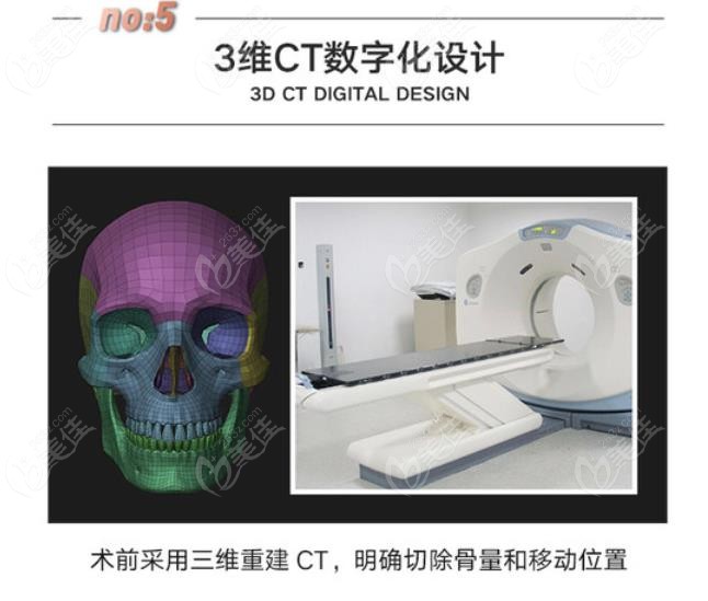 国字脸做下颌角磨骨好还是垫下巴好可以通过CT片子来判断