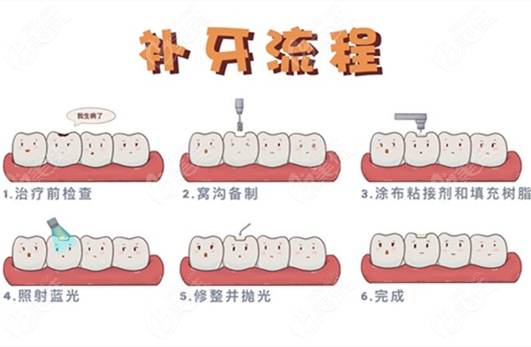 补牙的流程图片