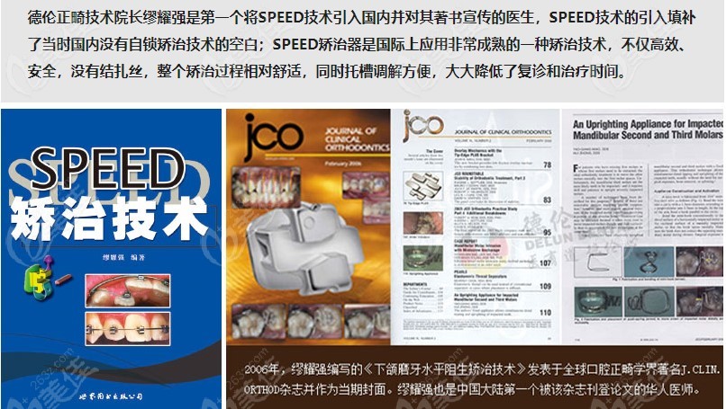 德伦口腔Speed矫治技术相关介绍
