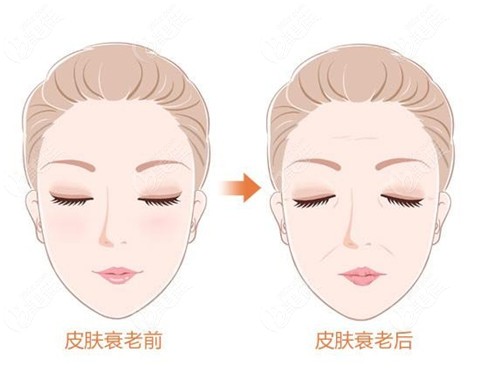 皮肤衰老做青春青春支架和热玛吉的区别