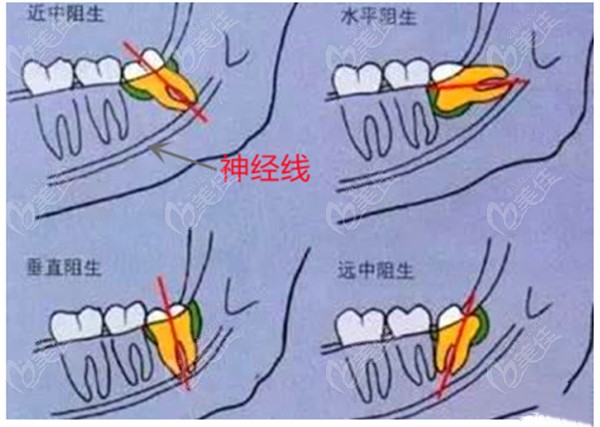 华阳口腔医院(华阳口腔医院慈溪电话)