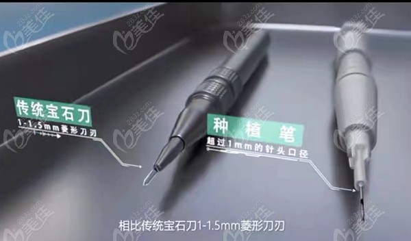 肇庆市毛发种植技术先进