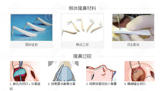 假體隆鼻材料及過程圖解 假體隆鼻材料及過程圖解