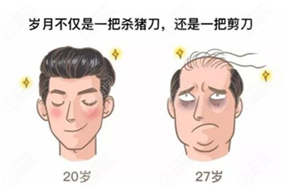 压力好大，不过几年就变秃头啦。赶快治疗吧