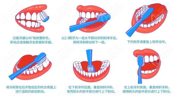 正确刷牙的步骤图