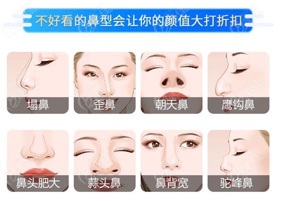 隆鼻及修复手术可以改善哪些问题 隆鼻及修复手术可以改善哪些问题