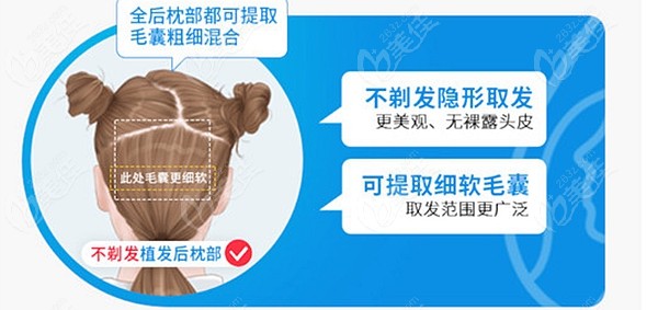 头发加密不剃头技术