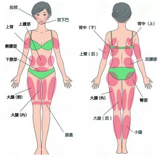 石家庄美莱吸脂怎么样