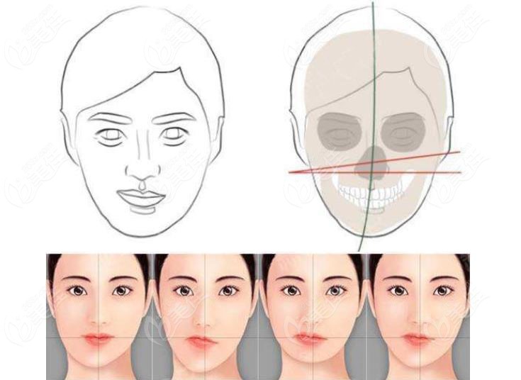 左右两边脸颧骨不对称导致大小脸怎么纠正好呢