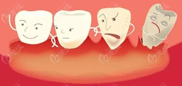 牙周炎的症状图