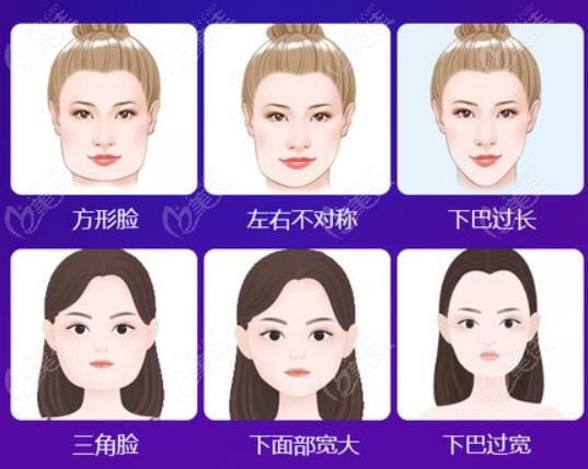 中国和韩国面部轮廓整形手术改善脸型