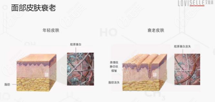 艾维岚抵抗面部衰老