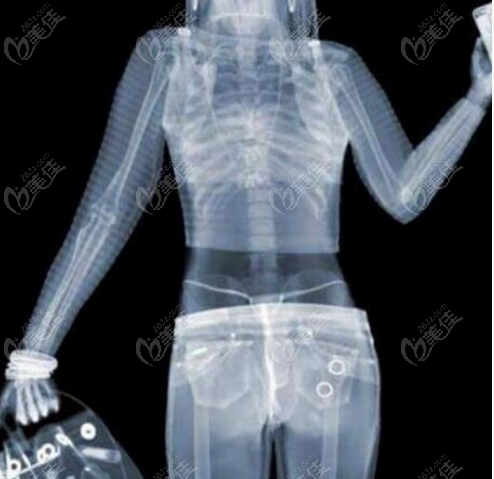 人体X光机安检成像