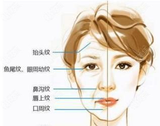 怎么才能变得有松弛感 20220117_1642395916481037.jpg