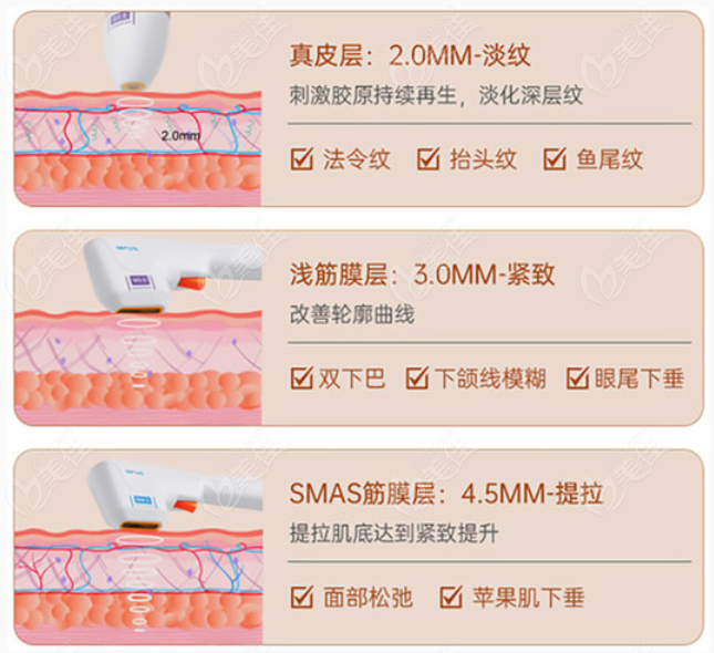 半岛超生炮不同探头的作用不同