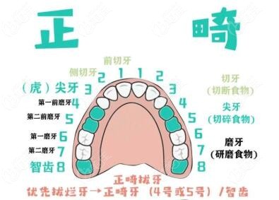牙齿矫正需要拔牙,拔4号,5号,智齿牙的区别是什么