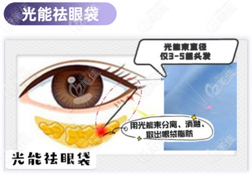 重庆华美光能祛眼袋技术