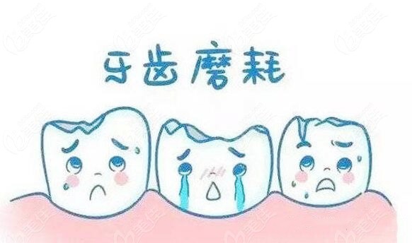 长期偏侧牙齿磨损