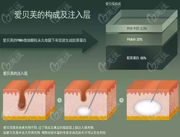 爱贝芙的组成部分