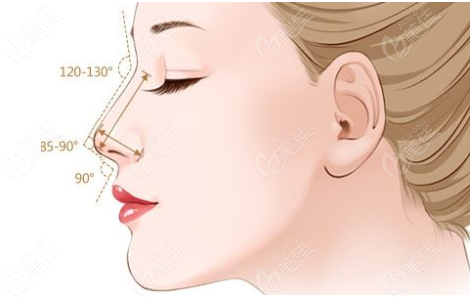 硅胶假体隆鼻一般多久会出现下滑呢？