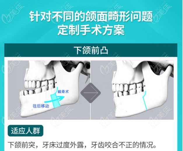 广州可以做正畸正颌手术的医院