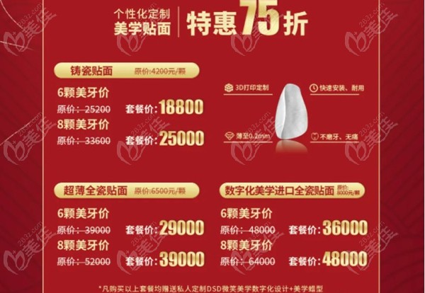 进口全瓷贴面的优惠图